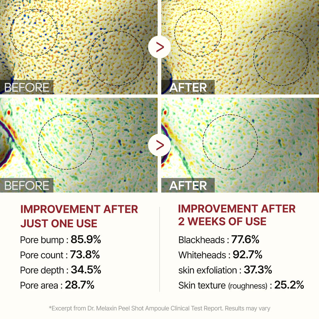 Dr. Melaxin Peel Shot White Rice Glow