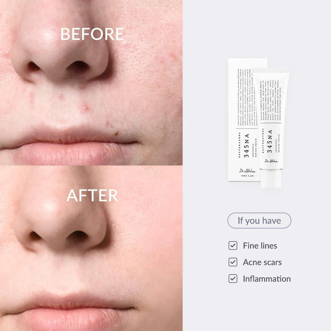 Dr.Althea 345 Relief Cream 50ml