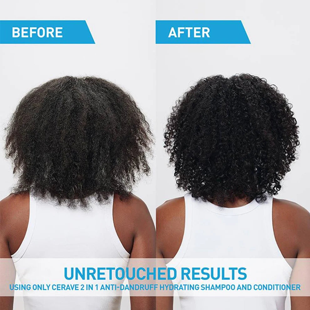 CeraVe 2-in-1 Anti-Dandruff Hydrating Shampoo and Conditioner