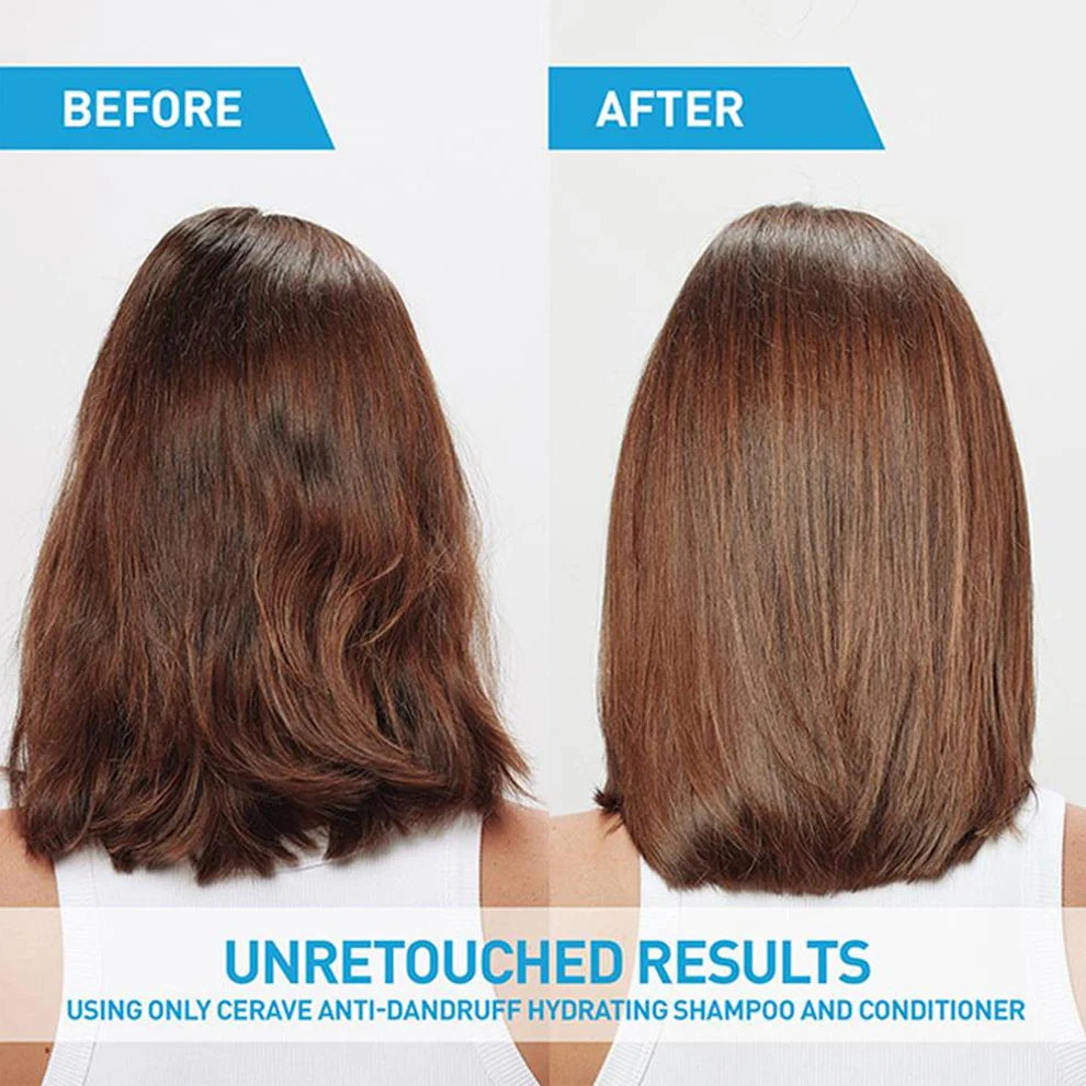 Anti-Dandruff Hydrating Conditioner | Cerave