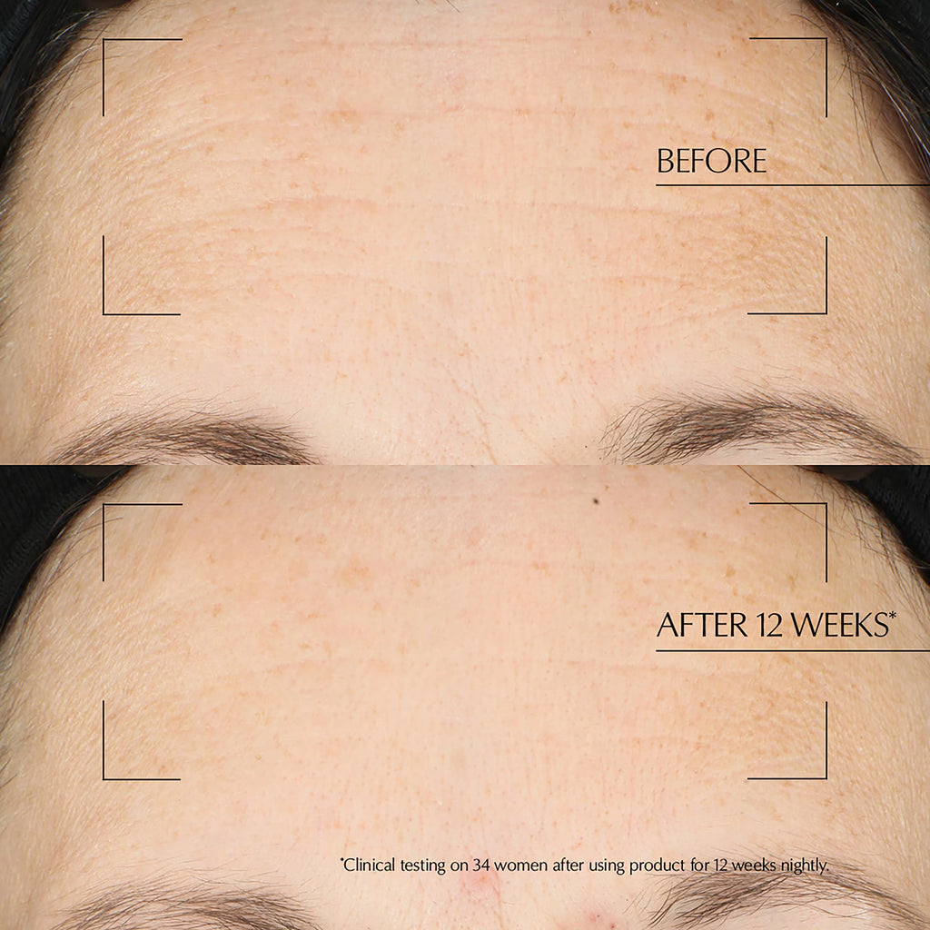 Estée Lauder Advanced Night Repair Overnight Treatment