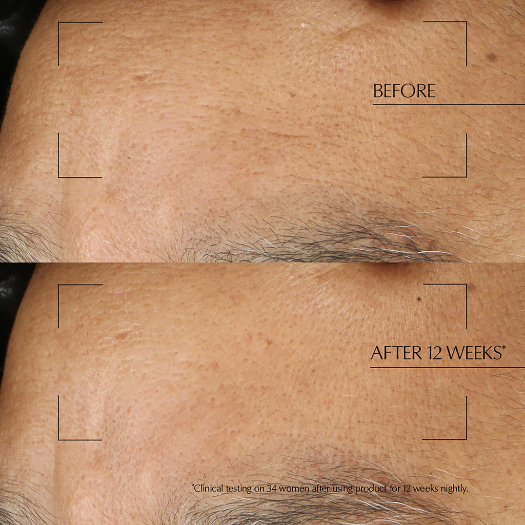 Estée Lauder Advanced Night Repair Overnight Treatment