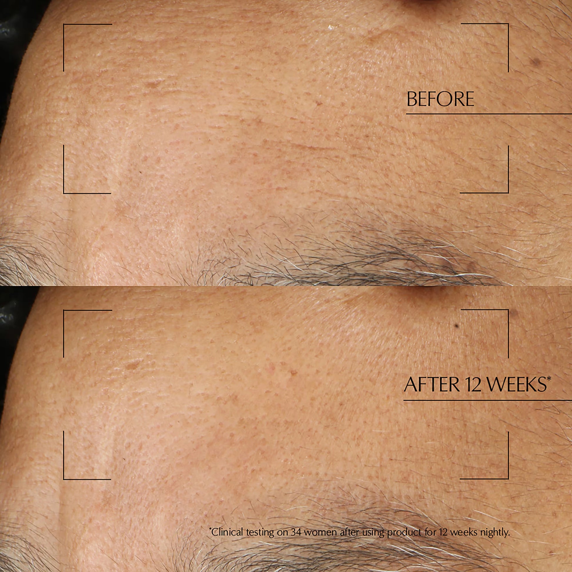 Estée Lauder Advanced Night Repair Overnight Treatment