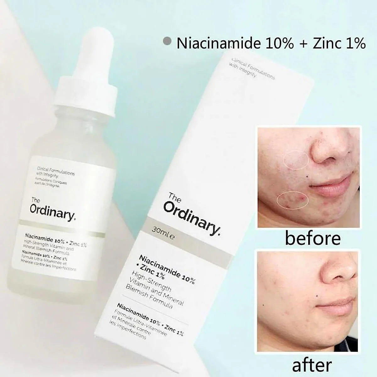 The Ordinary Niacinamide Serum 10% + Zinc 1%