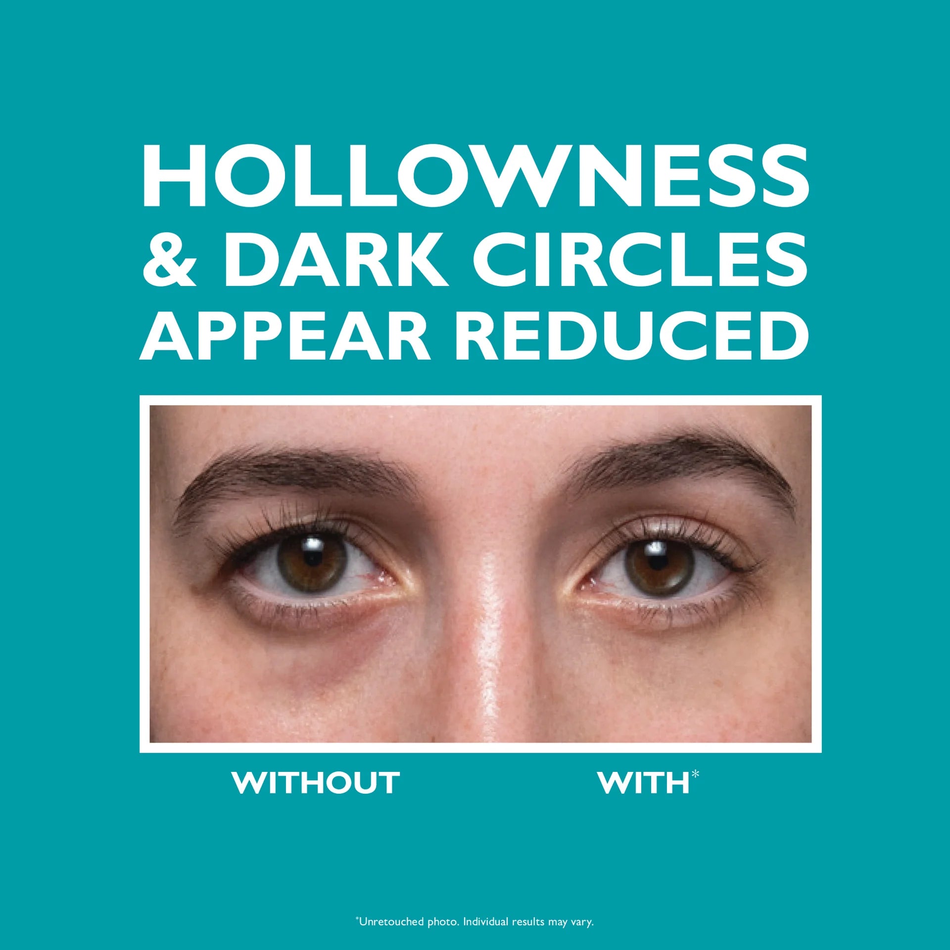 PTR Peptide Skinjection™ Fill + Fix Under-Eye Cream