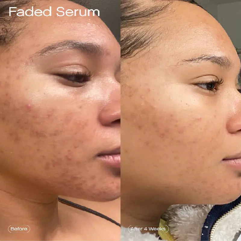 Topicals Faded Serum For Dark Spots & Discoloration