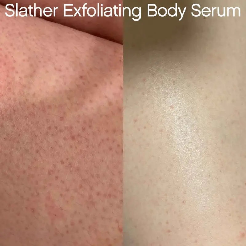 Topicals Slather Exfoliating Body Serum