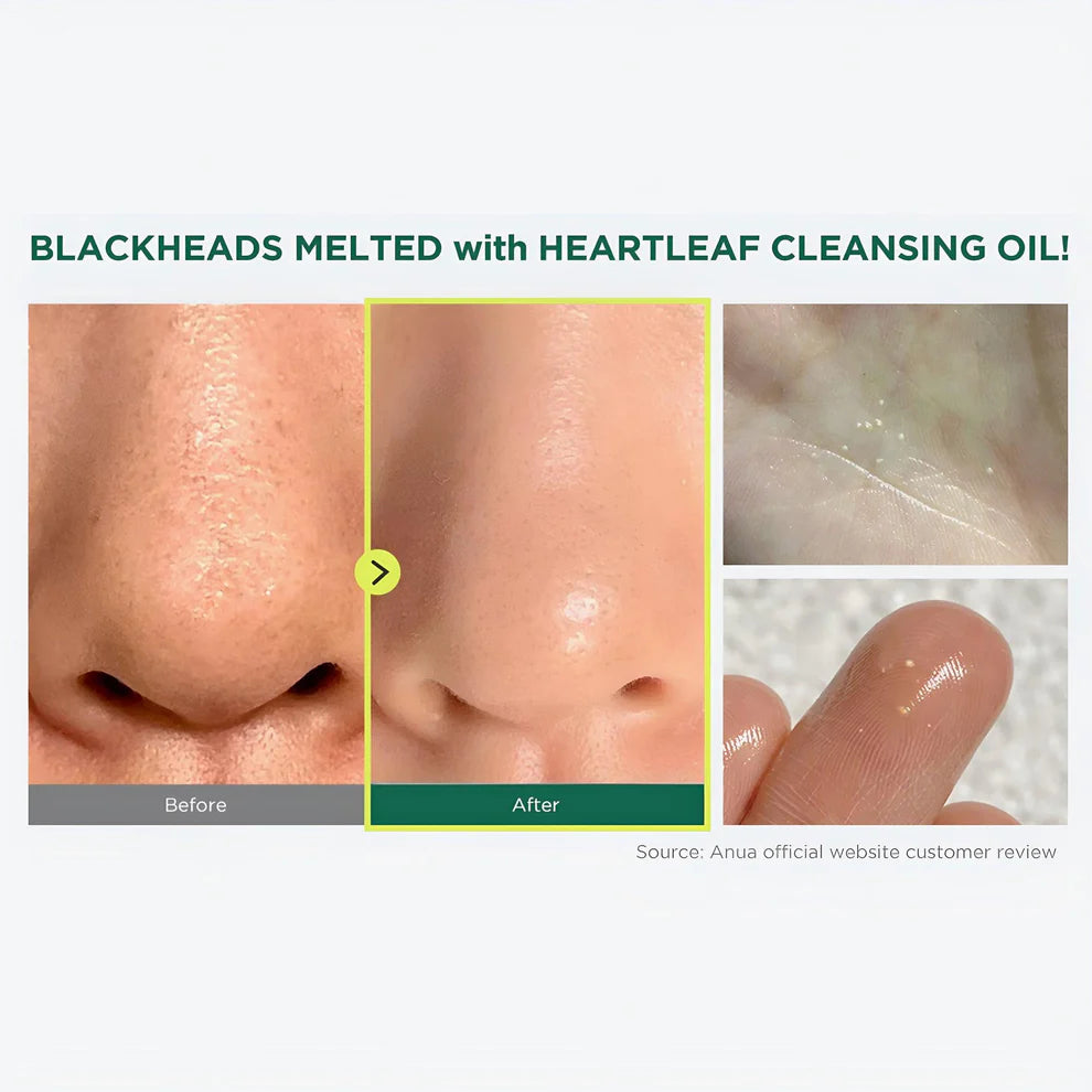 Heartleaf Pore Control Cleansing Oil 200ml | Anua