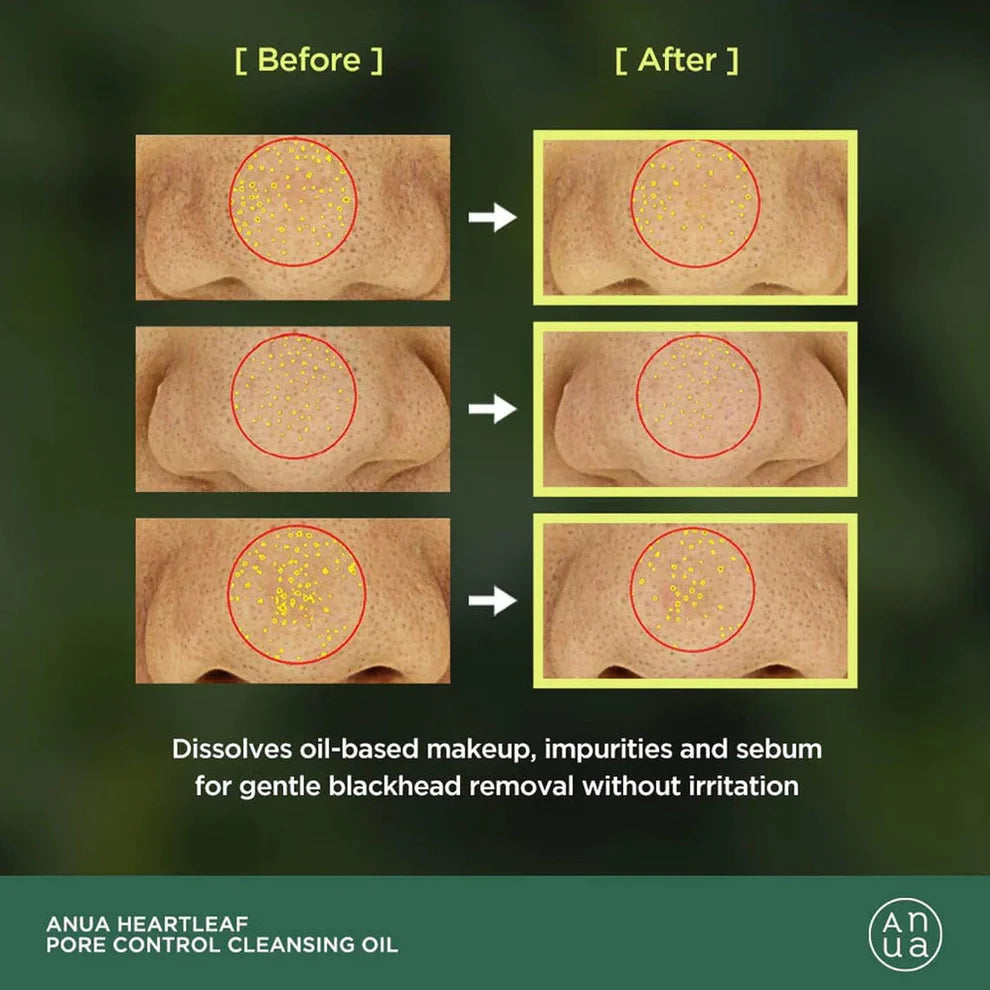 Heartleaf Pore Control Cleansing Oil | Anua