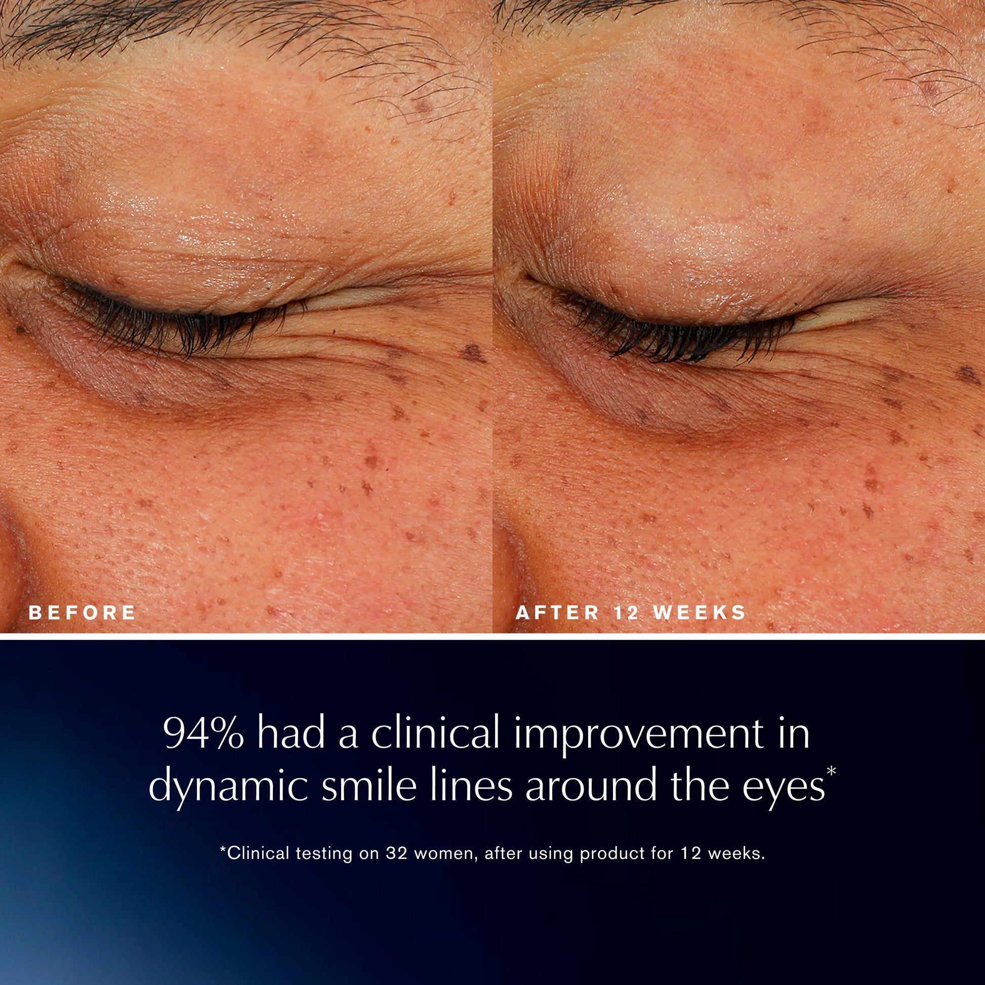 Estée Lauder Advanced Night Repair Eye Lift + Sculpt Eye Cream