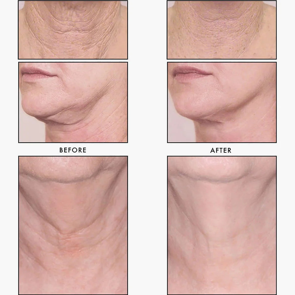 Revision Skincare Nectifirm Advanced Next Genration 48g